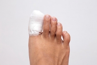 Symptoms of a Broken Toe