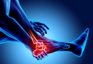 Early Signs and Risk Factors of Rheumatoid Arthritis